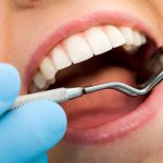 Periodontal Disease – You Might Have it and Not Even Know It